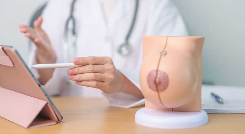 Reafirmación mamaria sin cicatrices: guía post embarazo